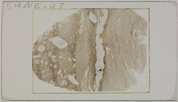 Thin section 54NC47, sapphire-bearing biotite schist