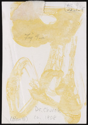 Dr. Church with snowshoes around neck, copy 1, verso